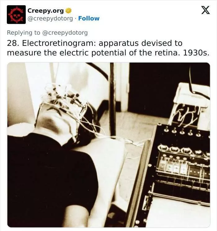 Traitements medicaux historiques bizarres qui vous donneront des frissons - #23 