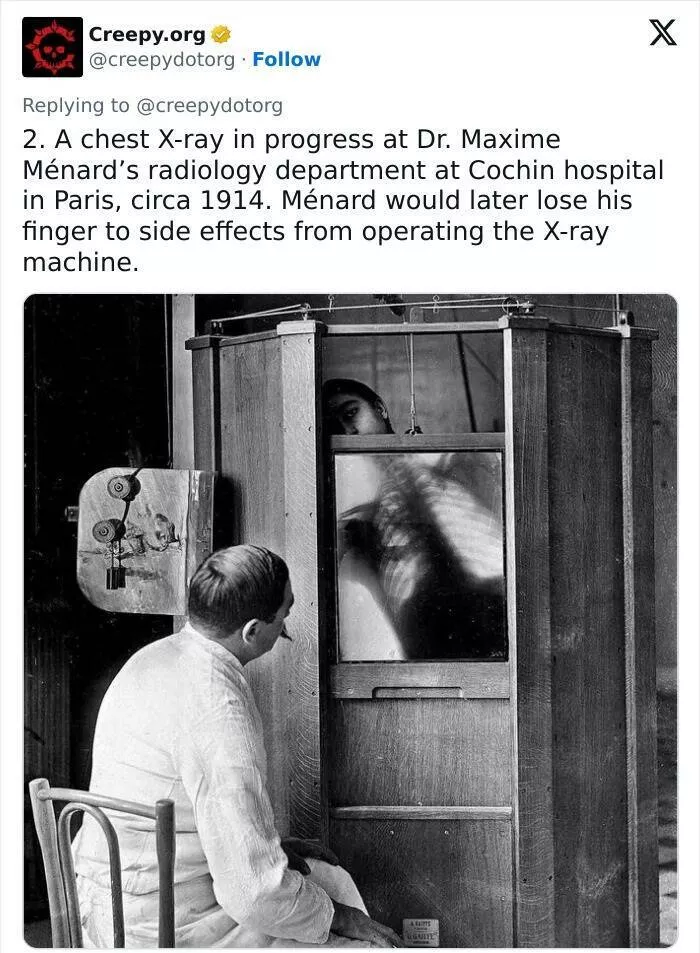 Traitements medicaux historiques bizarres qui vous donneront des frissons - #5 