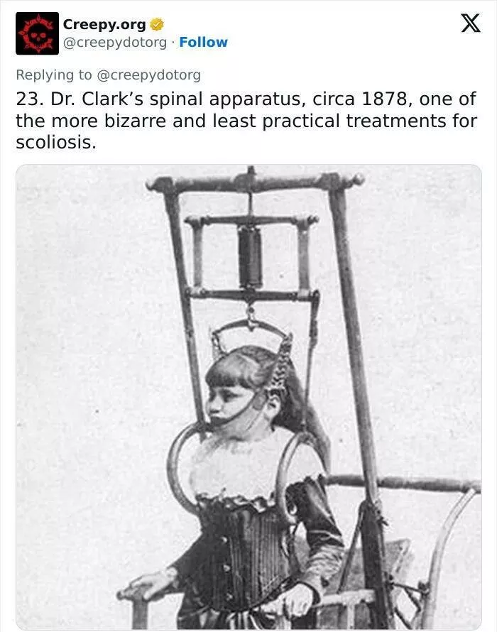 Bizarre historical medical treatments that will make you shudder - #6 