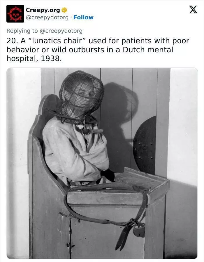 Bizarre historical medical treatments that will make you shudder - #7 