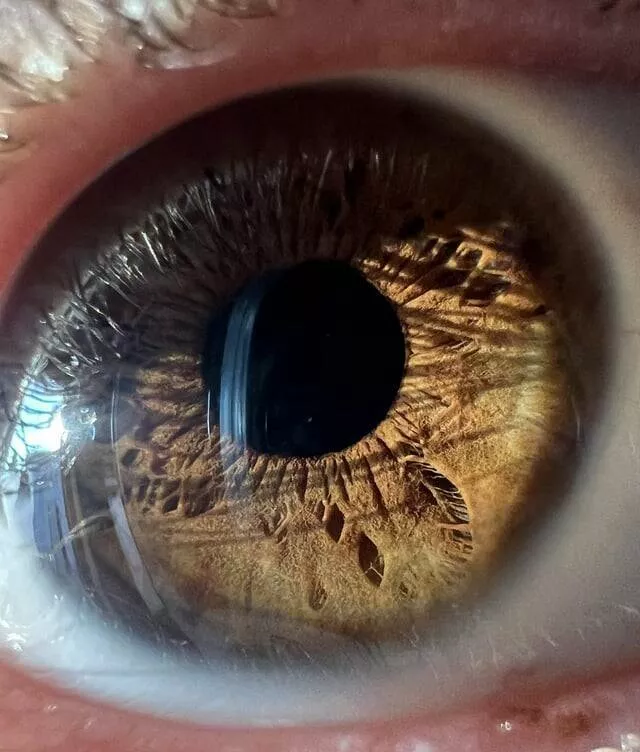 Photos intrigantes qui eveilleront votre curiosite - #11 J'ai une forme et une texture semblables à une plume au bas de mon iris