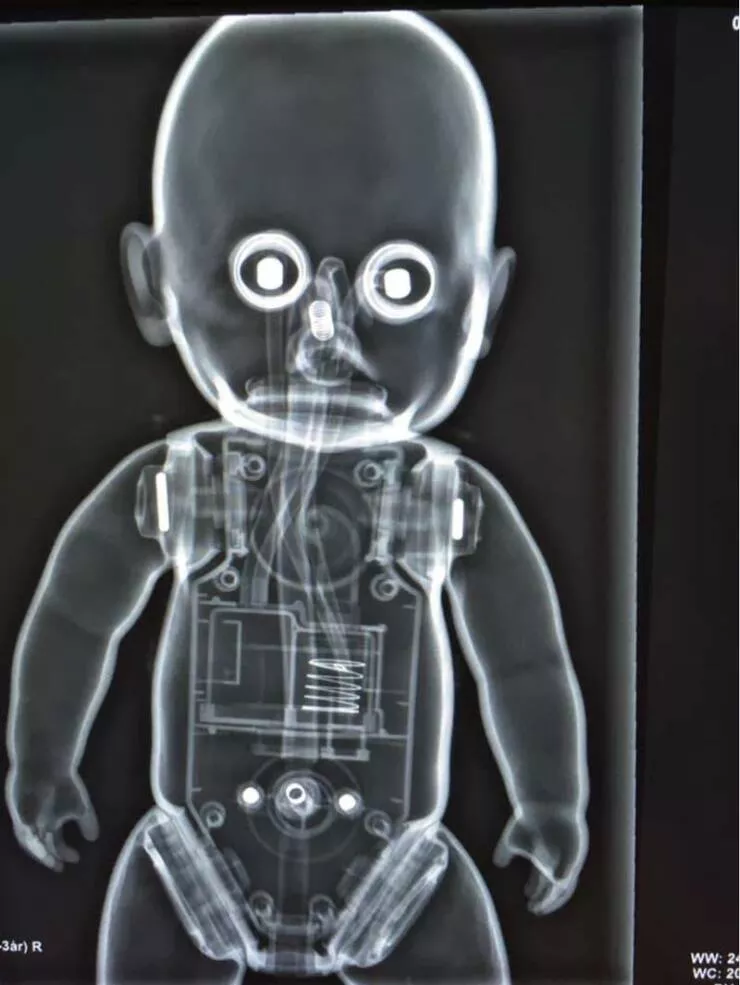 Photos effrayantes qui hantent vos reves - #35 Rayon X Inquiétant - Cet rayon X absolument dérangeant d'une poupée d'enfant qui semble me fixer dans l'âme et est à 0,0005 secondes de me posséder, probablement.