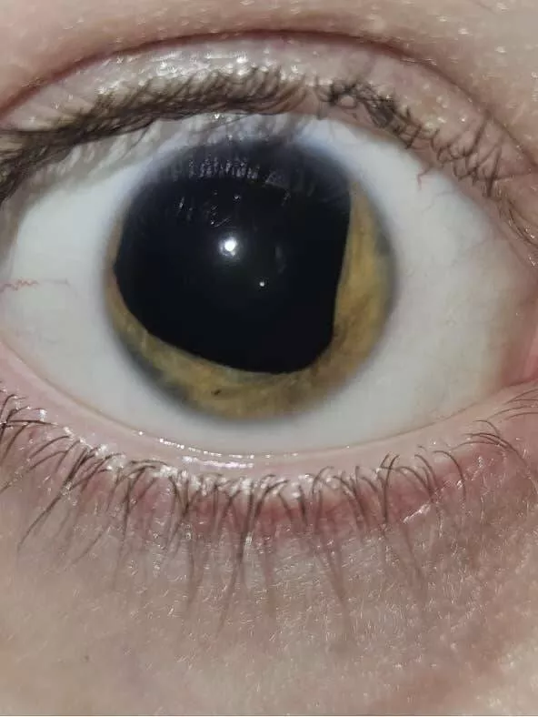 Chilling photos that will haunt your dreams - #4 Pupil Stare - A person's pupil that's irresistibly captivating to look at. Chilling photos that will haunt your dreams - #4 Pupil Stare - A person's pupil that's irresistibly captivating to look at.