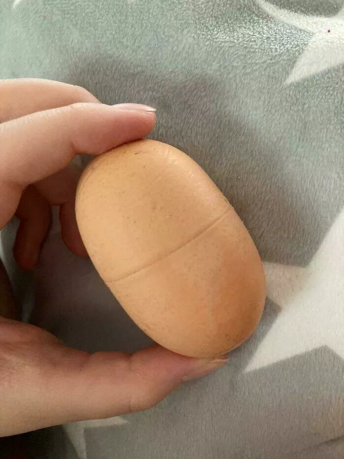 Amazing photos of unbelievably rare coincidences - #27 Conjoined Eggs
