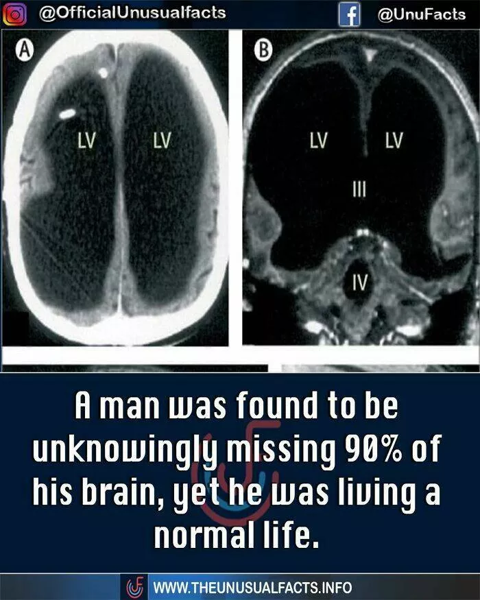 Mind blowing facts and astonishing wonders from around the world - #51 