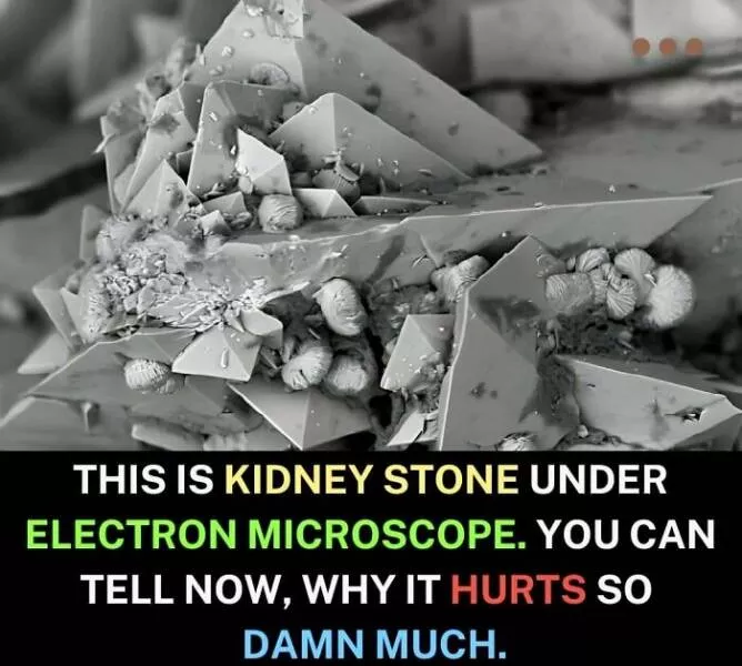 Mind blowing facts and astonishing wonders from around the world - #52 