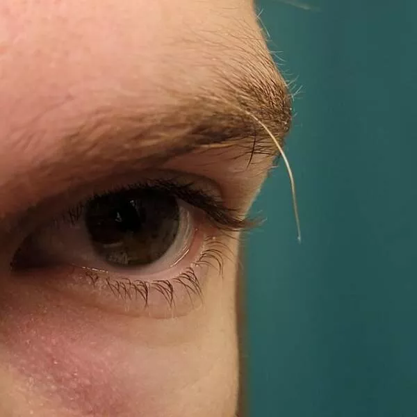 Intriguing photos that will instantly capture your attention - #9 I Have One Long Eyebrow Hair That Keeps Growing Back