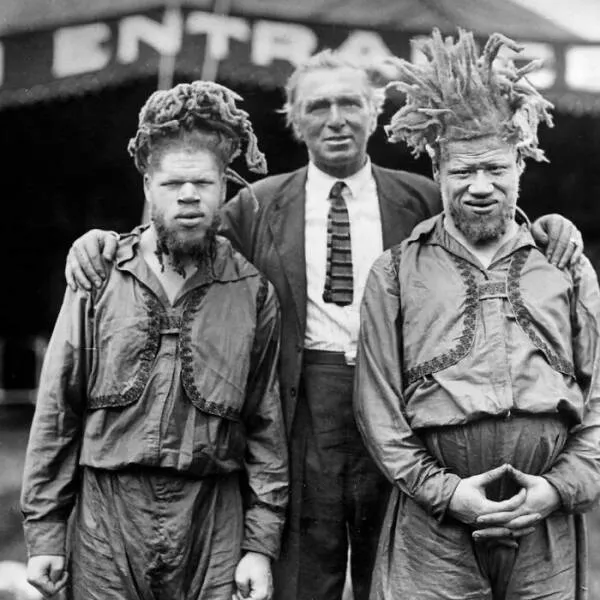 Moments fascinants de lhistoire captures en photos - #23 George Et Willie Muse : Deux Frères Afro-Américains Kidnappés En Enfants En 1899 Et Forcés À Être Des Attractions De Foire À Cause De Leur Albinisme Moments fascinants de lhistoire captures en photos - #23 George Et Willie Muse : Deux Frères Afro-Américains Kidnappés En Enfants En 1899 Et Forcés À Être Des Attractions De Foire À Cause De Leur Albinisme