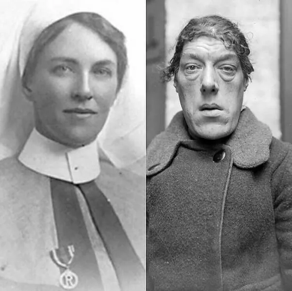 Moments fascinants de lhistoire captures en photos - #28 Mary Ann Bevan (1874 - 1933) : La Femme Anglaise Qui A Parcouru Le Circuit Des Sideshows En Tant Que Moments fascinants de lhistoire captures en photos - #28 Mary Ann Bevan (1874 - 1933) : La Femme Anglaise Qui A Parcouru Le Circuit Des Sideshows En Tant Que