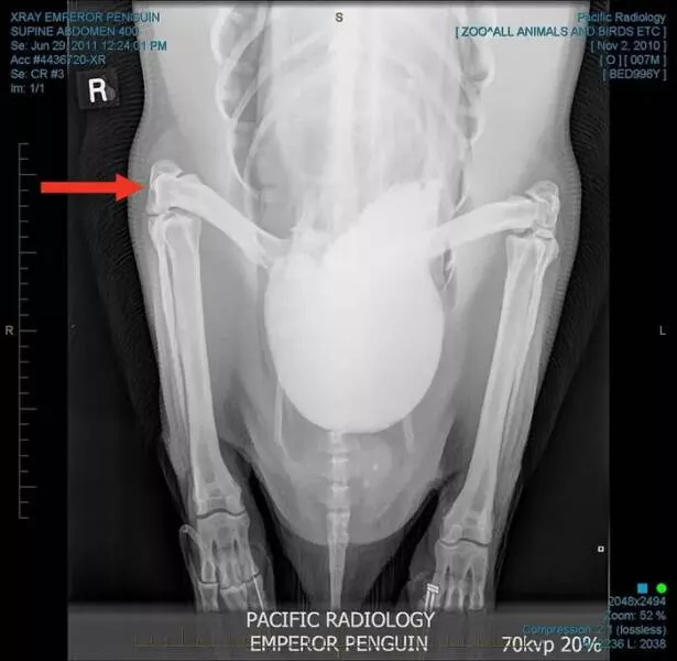 Rare and fascinating photos you have to see - #17 Penguins have knees!