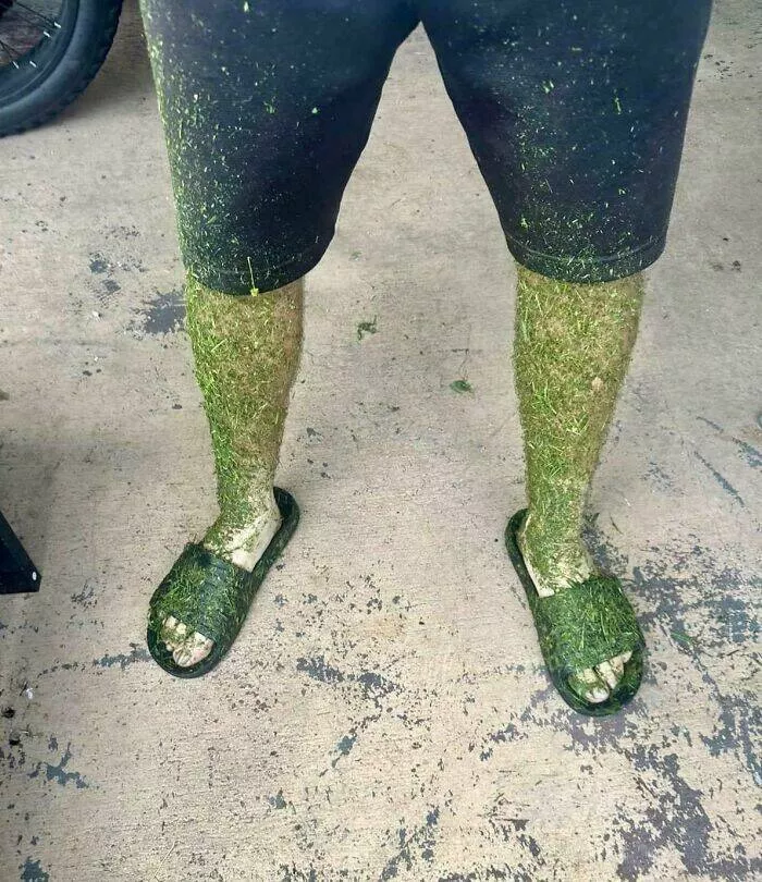 Hilarious blunders that are simply too much - #25 My Legs After Mowing the Lawn While It Was Still Wet Hilarious blunders that are simply too much - #25 My Legs After Mowing the Lawn While It Was Still Wet
