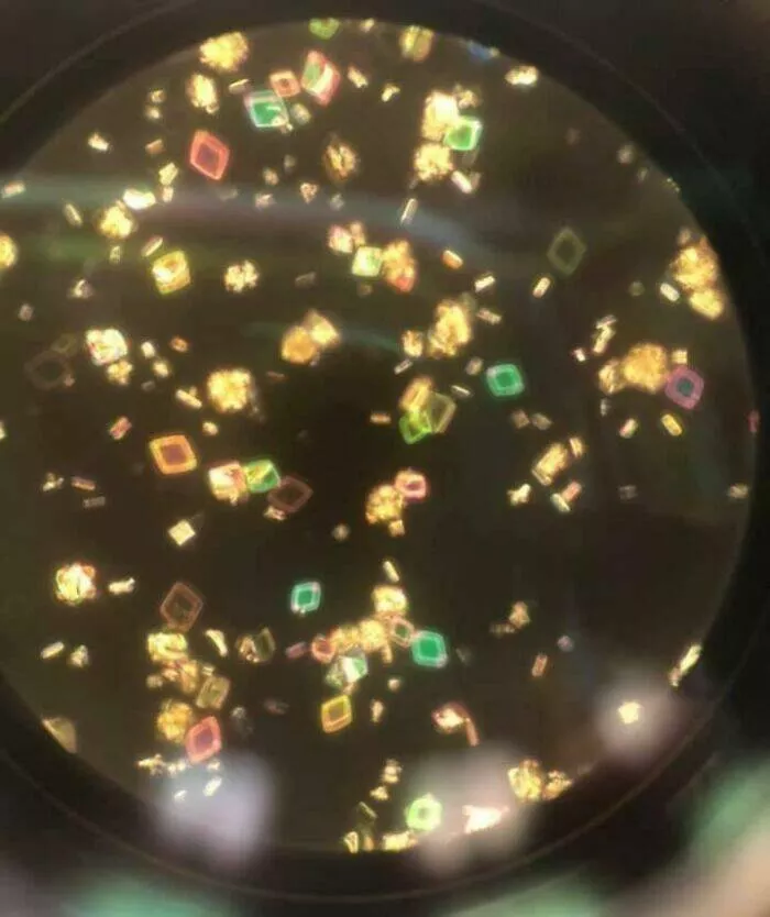 Sexy closeups of ordinary things - #13 Sharp Uric Acid Crystals Found In A Urine Sample Under Magnification