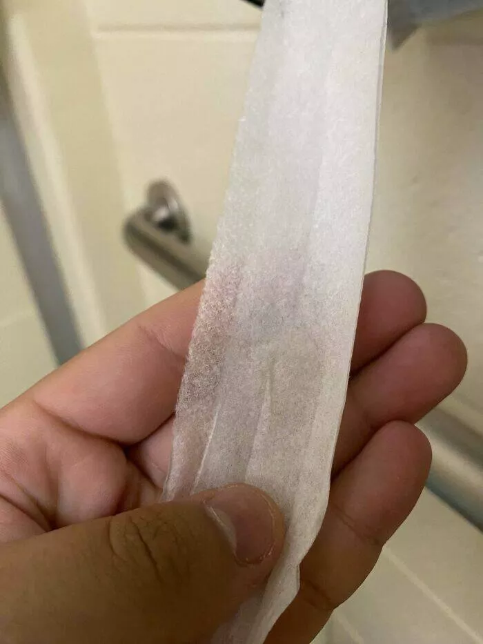 Toxic workplaces exposed through unbelievable photos - #31 Toilet Paper At My Job Looks Like This Now