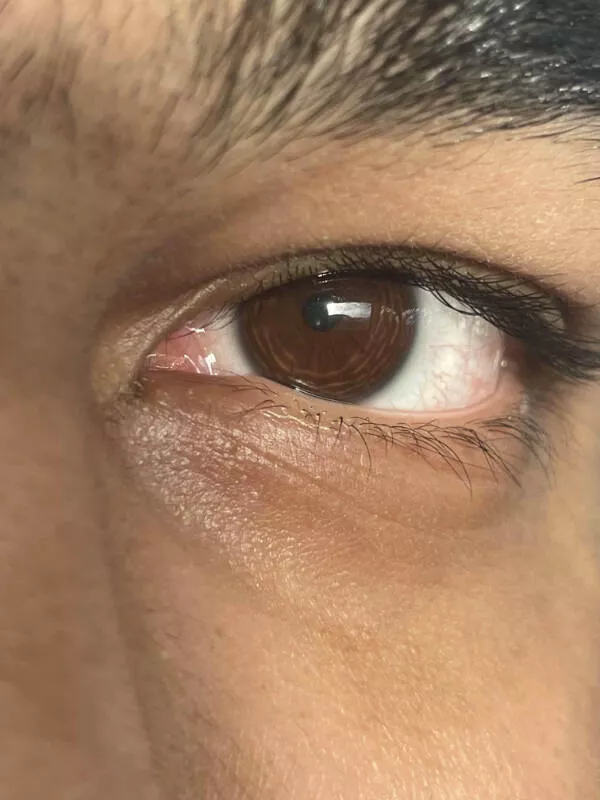 Striking photos youll instantly want to show others - #21 Rings Around My Eye Pupils