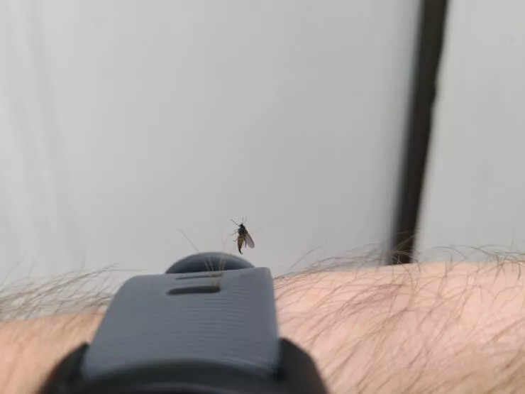 Striking photos youll instantly want to show others - #6 Mosquito Stuck On Arm Hair Striking photos youll instantly want to show others - #6 Mosquito Stuck On Arm Hair
