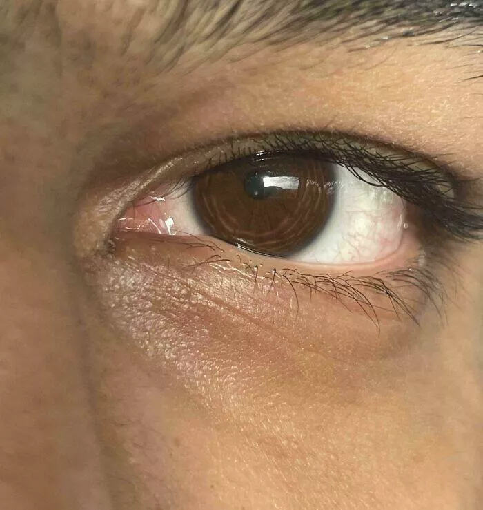 Intriguing photos with amazing stories - #25 Eyes with Circular Patterns Around the Pupils