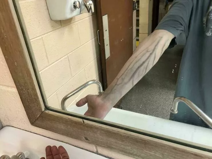 Intriguing photos with amazing stories - #42 My Blood Vessels Seem to Trap More Dirt Than Normal