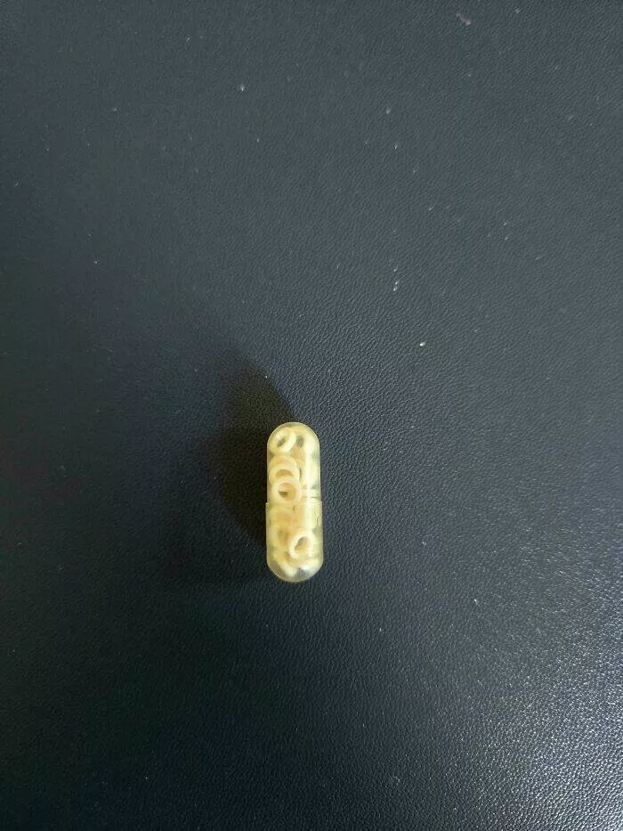 Intriguing photos with amazing stories - #46 My Mom’s Pill Is Filled with Tiny Circular Tablets