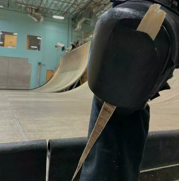 Against all odds stories of incredible fortune - #35 Knee pad caught a tiny splinter