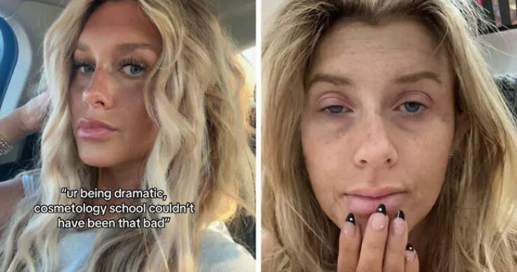 Before and after lifes transformations - #14 