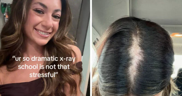 Before and after lifes transformations - #2 