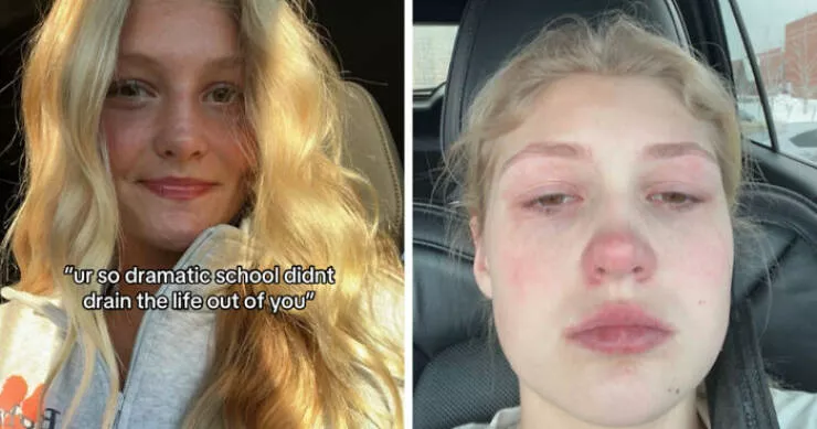 Before and after lifes transformations - #24 