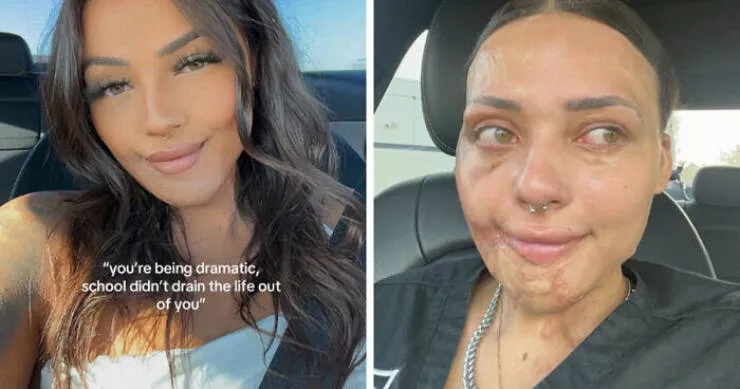 Before and after lifes transformations - #4 