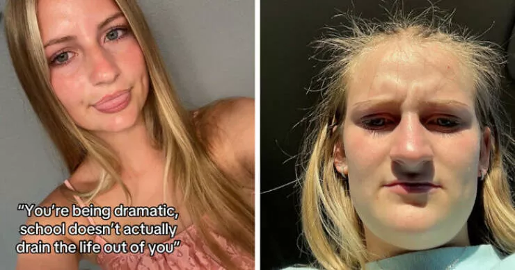 Before and after lifes transformations - #6 