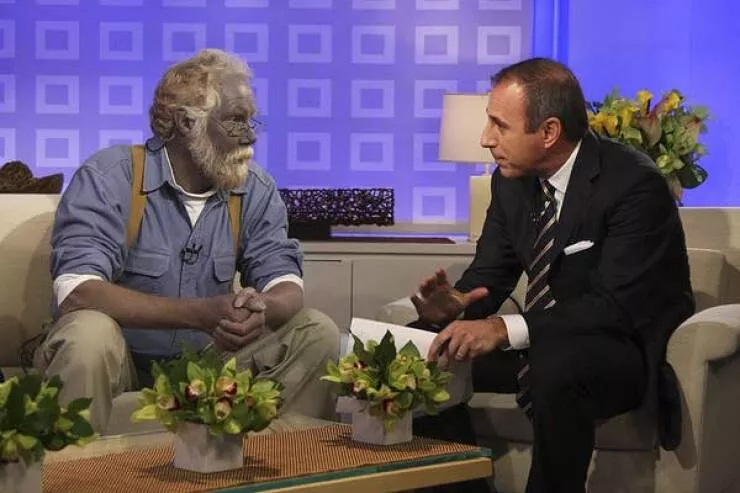 Picdump 1065 - #69 Side by side: sky-blue skin next to natural human tone