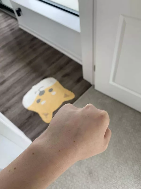 Photos that are just too cool to scroll past - #10 A unique hand, missing a knuckle