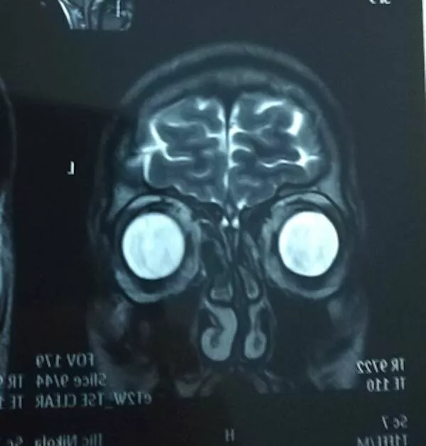 Intriguing photos a gallery of captivating shots - #4 My MRI gave me a surprisingly cool profile picture