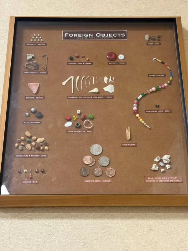 Awesome pictures worth sharing - #8 An ENT doctor displays items removed from patients