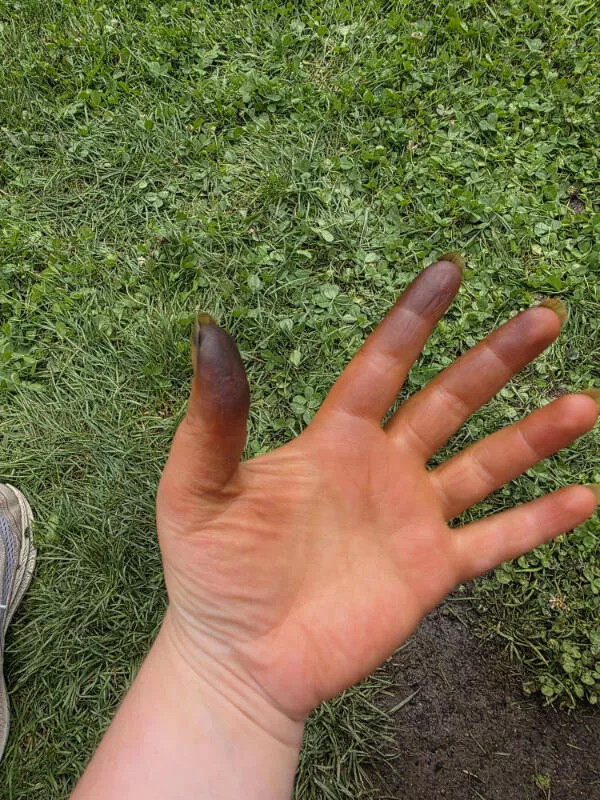 Feeling bad these folks have it worse - #9 My gloves ripped while pulling husks off black walnuts Feeling bad these folks have it worse - #9 My gloves ripped while pulling husks off black walnuts