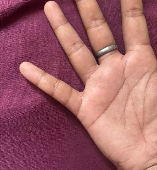 Incredible photos that are worth sharing - #16 I have four lines on my right pinky finger Incredible photos that are worth sharing - #16 I have four lines on my right pinky finger