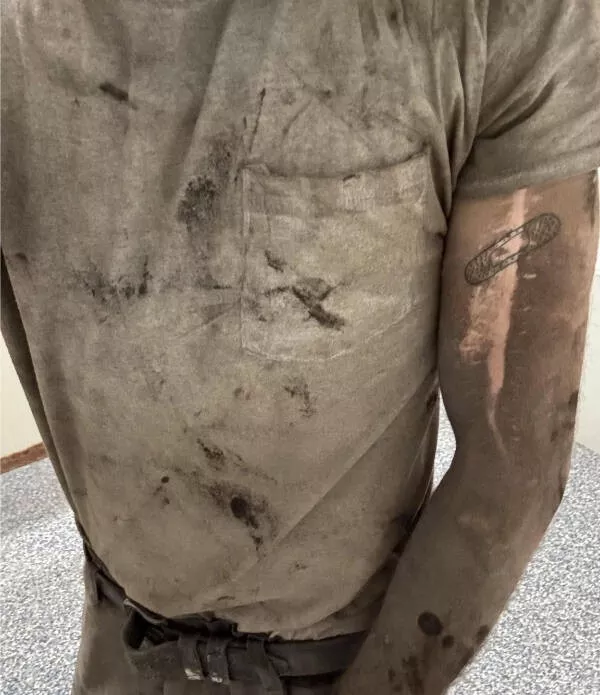 Incredible photos that are worth sharing - #7 My scar is completely resistant to dirt Incredible photos that are worth sharing - #7 My scar is completely resistant to dirt