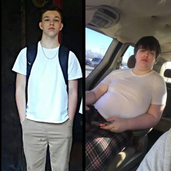 A collection of people having a worse day - #1 Gained fifty pounds after breaking my leg A collection of people having a worse day - #1 Gained fifty pounds after breaking my leg