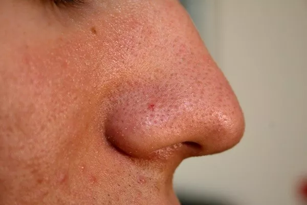 Useless facts youll definitely forget - #9 Your nose and ears never stop growing