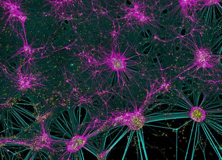 Explore the nikon small world micro photos - #24 Honorable Mention: Dr. Bruno Cisterna And Dr. Eric Vitriol, Augusta, USA Explore the nikon small world micro photos - #24 Honorable Mention: Dr. Bruno Cisterna And Dr. Eric Vitriol, Augusta, USA