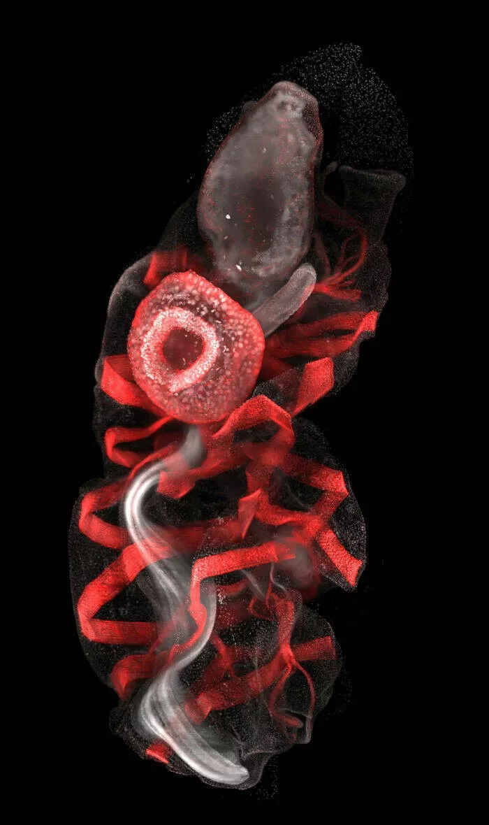 Decouvrez le monde miniature de nikon - #27 Image de distinction : Dr. Mette Handberg-Thorsager et al., Göttingen, Allemagne Decouvrez le monde miniature de nikon - #27 Image de distinction : Dr. Mette Handberg-Thorsager et al., Göttingen, Allemagne