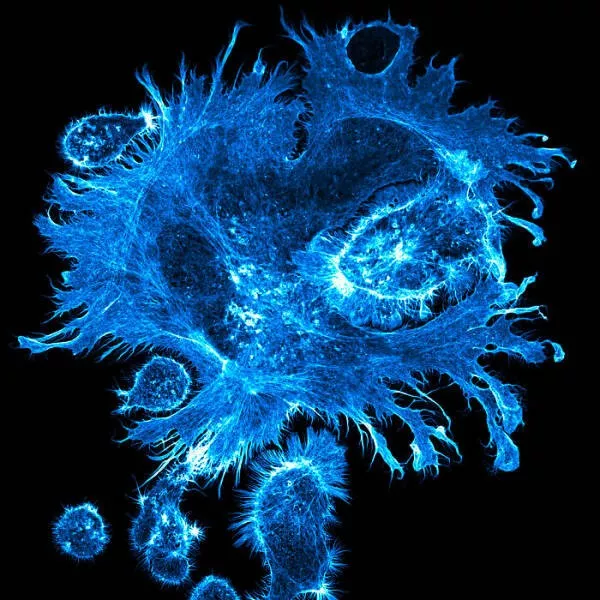 Explore the nikon small world micro photos - #30 Image Of Distinction: Joe Mckellar, Montpellier, France Explore the nikon small world micro photos - #30 Image Of Distinction: Joe Mckellar, Montpellier, France