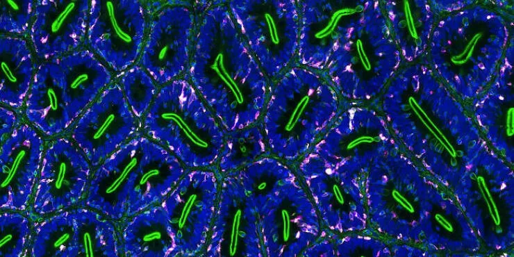 Explore the nikon small world micro photos - #40 Image Of Distinction: Dr. Julien Resseguier, Oslo, Norway Explore the nikon small world micro photos - #40 Image Of Distinction: Dr. Julien Resseguier, Oslo, Norway