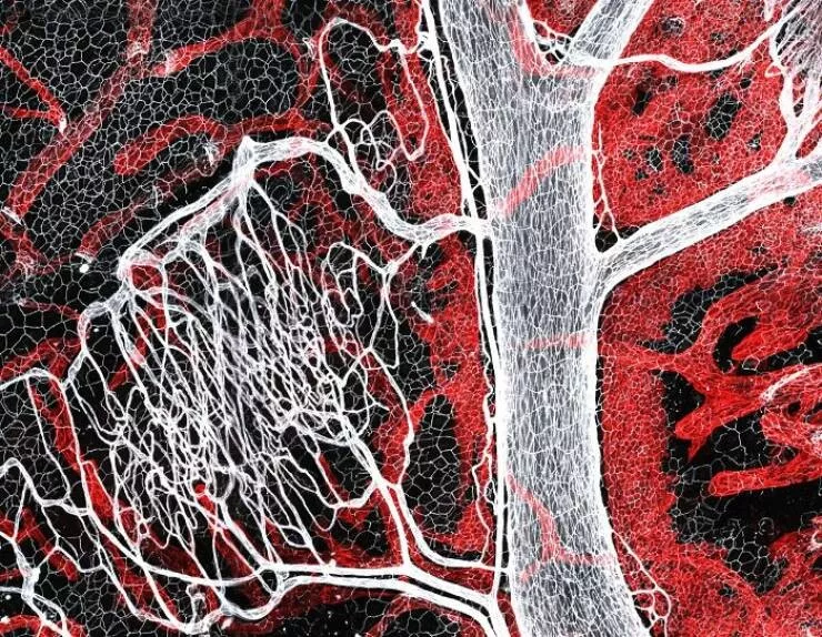 Explore the nikon small world micro photos - #47 Image Of Distinction: Shambhavi Dwivedi And Dr. Friedemann Kiefer, Muenster, Germany Explore the nikon small world micro photos - #47 Image Of Distinction: Shambhavi Dwivedi And Dr. Friedemann Kiefer, Muenster, Germany