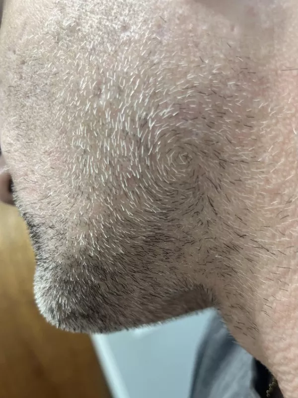 Mildly interesting moments caught in pics - #8 The Swirl. My facial hair grows in a circular pattern at the back of my jawline Mildly interesting moments caught in pics - #8 The Swirl. My facial hair grows in a circular pattern at the back of my jawline