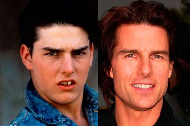 Best before and after pictures - #6 